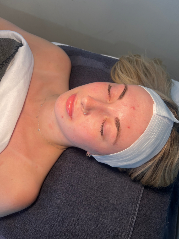 Skin Consultation