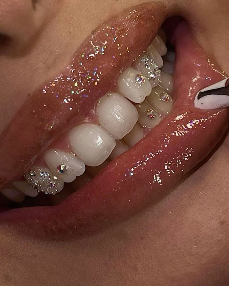 Tooth Gems