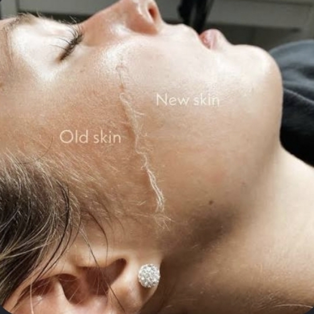 Express Facial with Dermaplane at Mezmorize in Anderson, IN