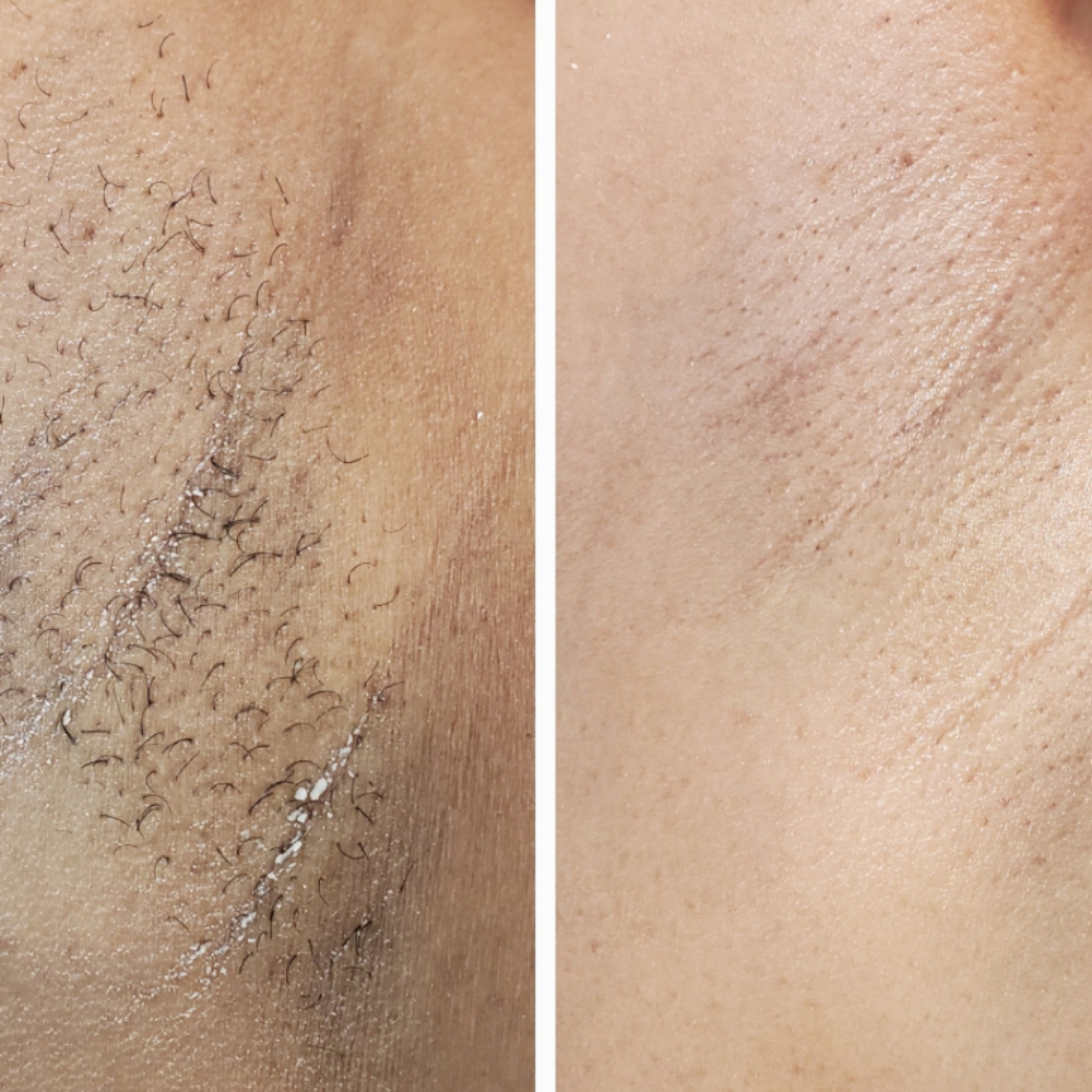 Underarm Wax at Skin Romance Spa And Beauty Lounge in Clifton Heights, PA