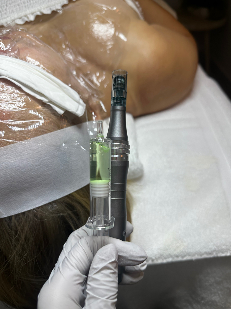 Microneedling at Naked Skin Studio in Las Piedra, PR