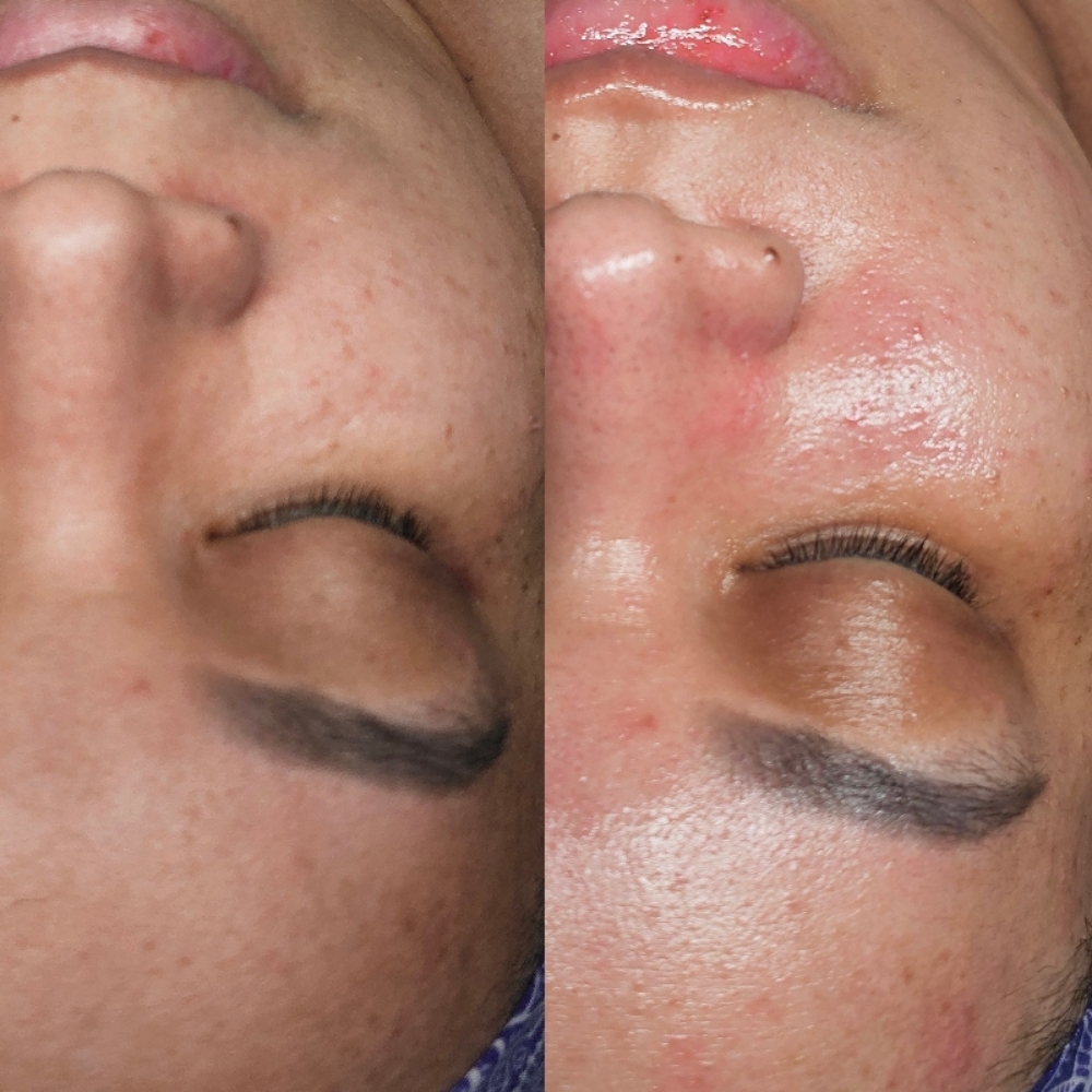 The Replenishment Facial at Aligned Beauty & Wellness in Davenport, IA
