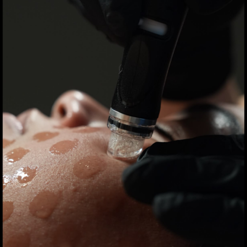 HydraFacial at Espy Esthetics in Midland, TX