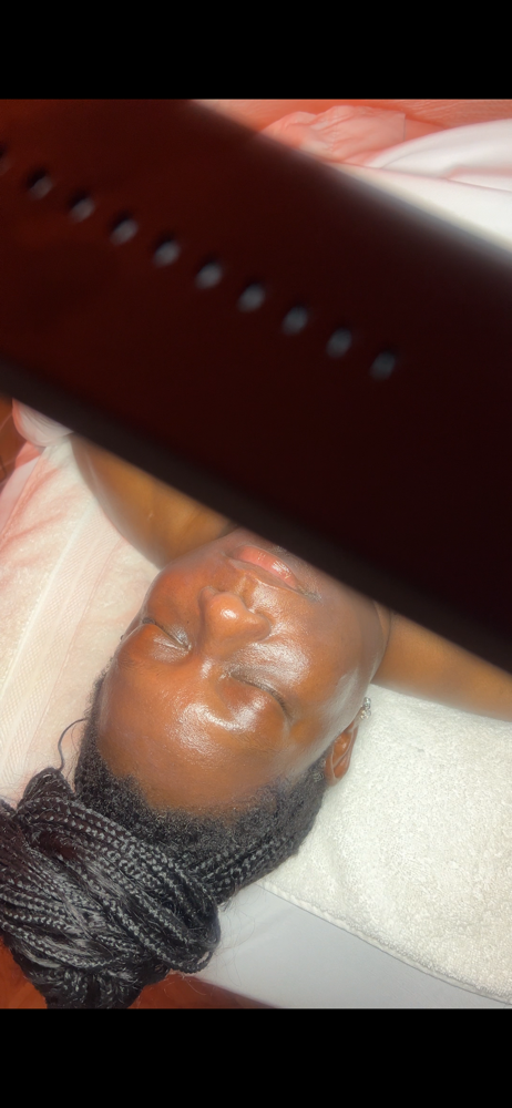 Glass Skin Treatment / Peel