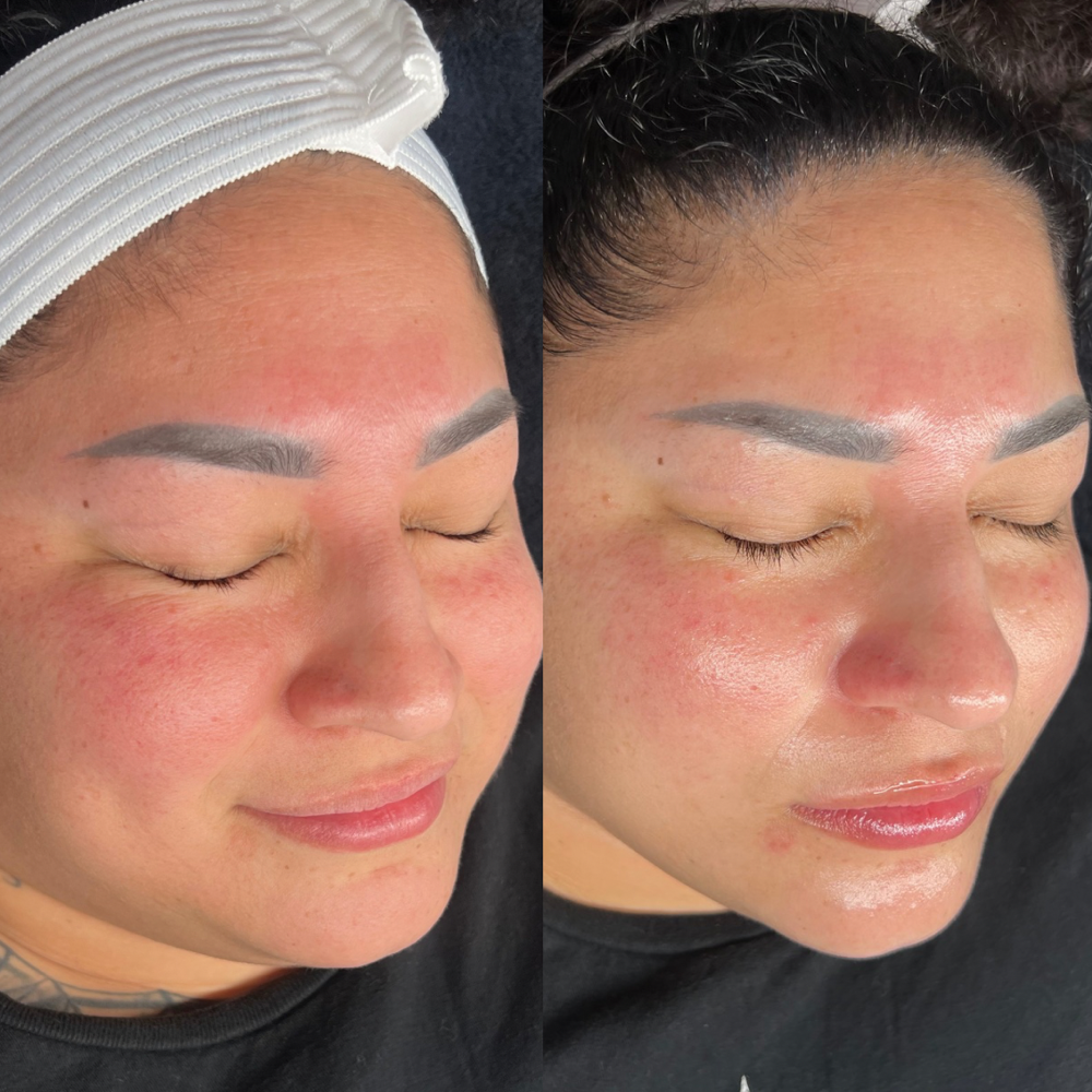 Customized Basic Facial