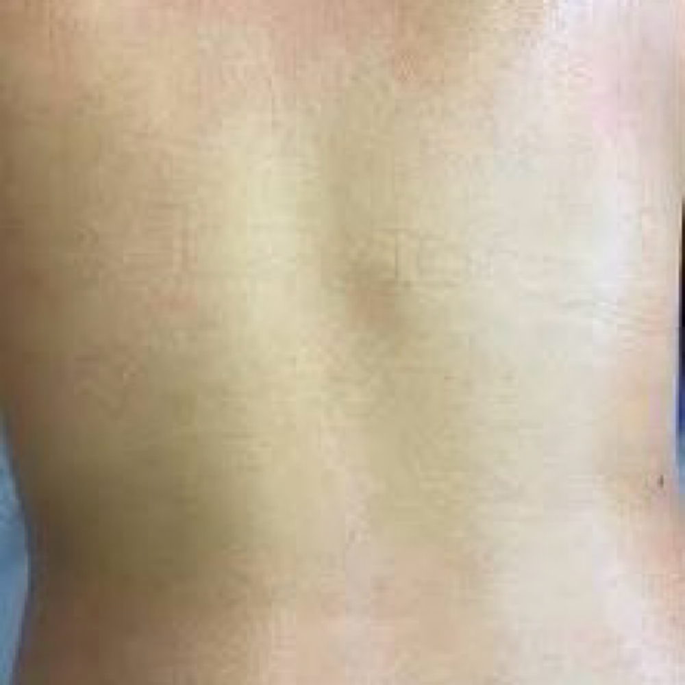 Full Back at iSugar Waxing Studio in Redondo Beach, CA