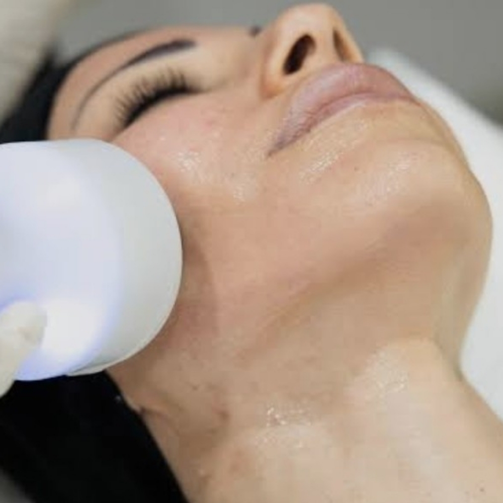Cryotherapy Facial or Double Chin at Top Tier Massage & Wellness LLC in Abingdon, MD