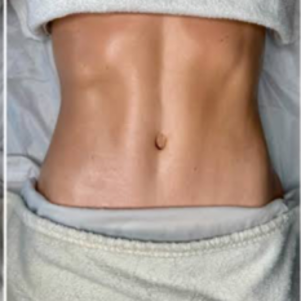 Sculpt & Restore Post Op (5) at Beauty And Body in San Dimas, CA