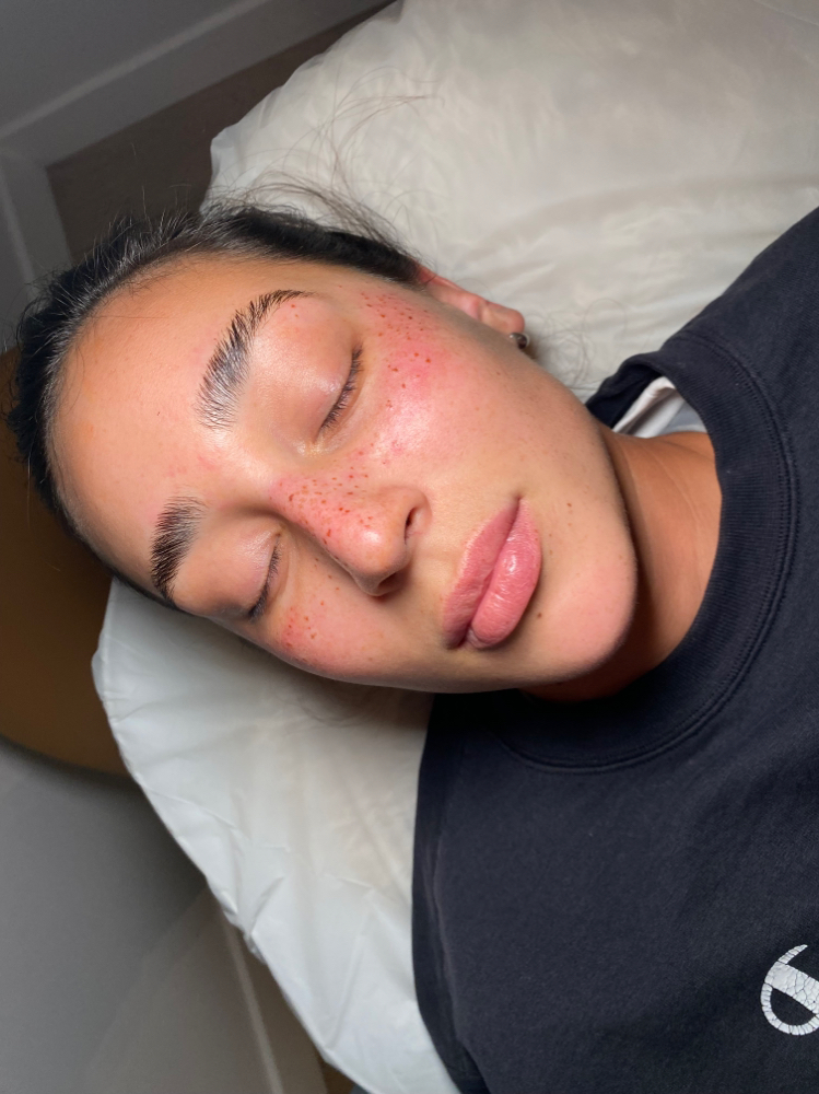 FAUX FRECKLES- LIGHT/MED COVERAGE