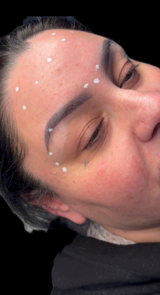 Tox Balance - 50 Units at Balance.Bar.Aesthetics in Berkeley, CA