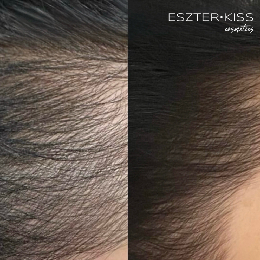 Advanced Scalp & Hair Restorati at Eszter Kiss Cosmetics in Deltona, FL