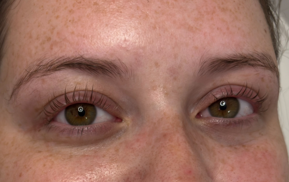 Lash Lift