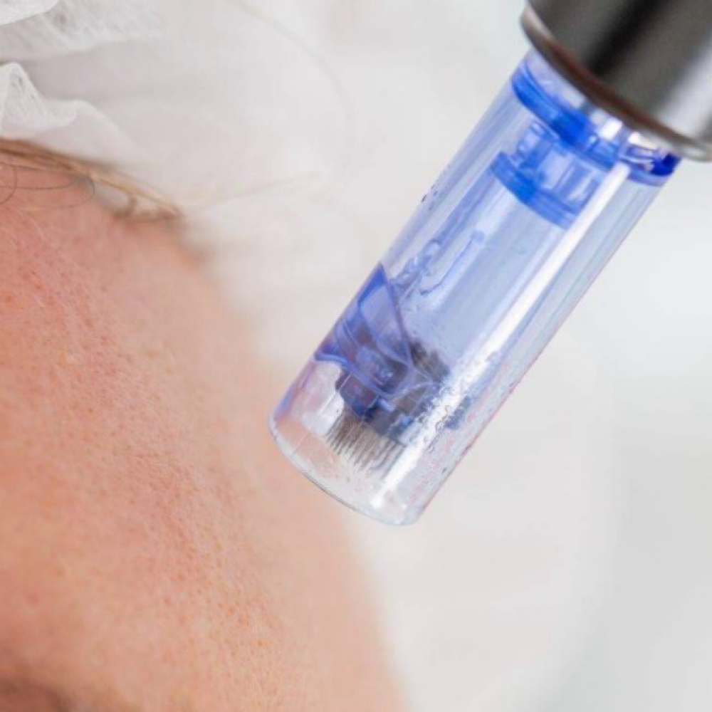 Microneedling at Blonde Blow Dry & Brow Salon in Yuma, AZ