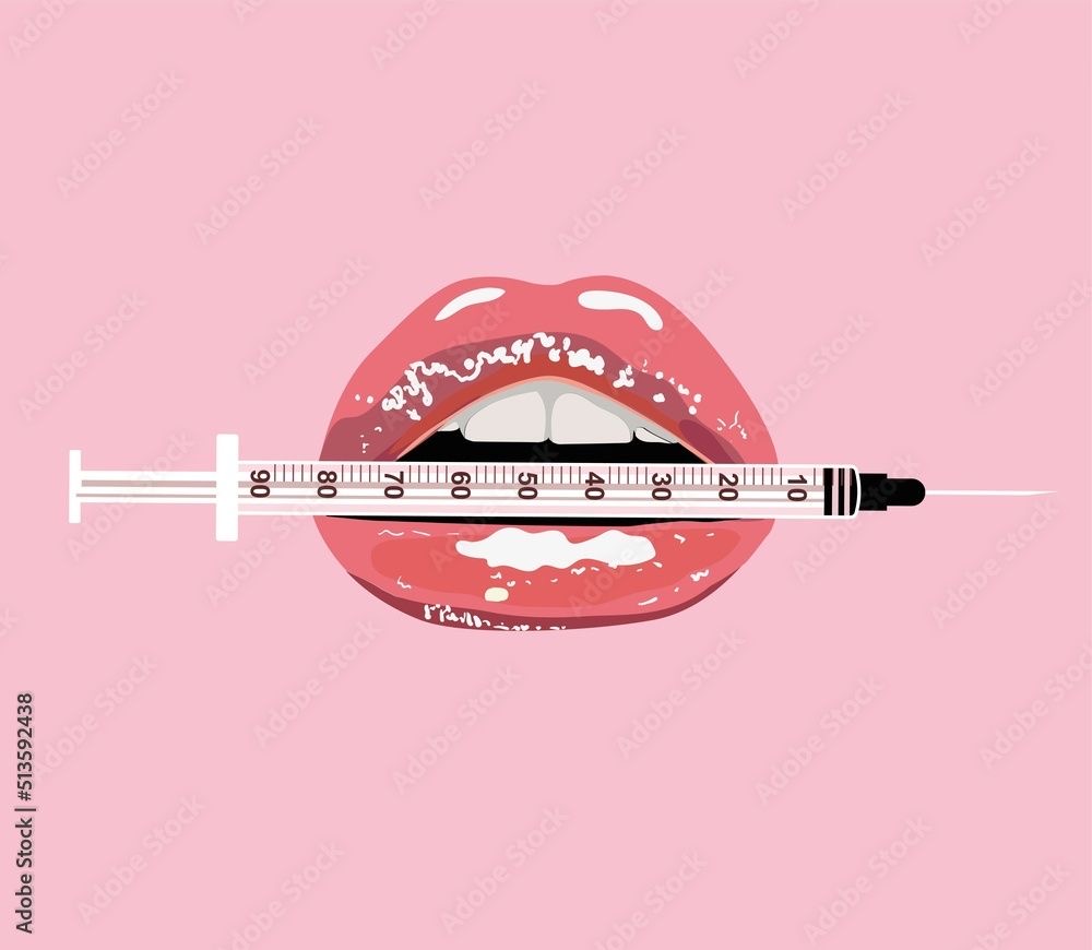 Hyaluronic Acid Lip Fillers