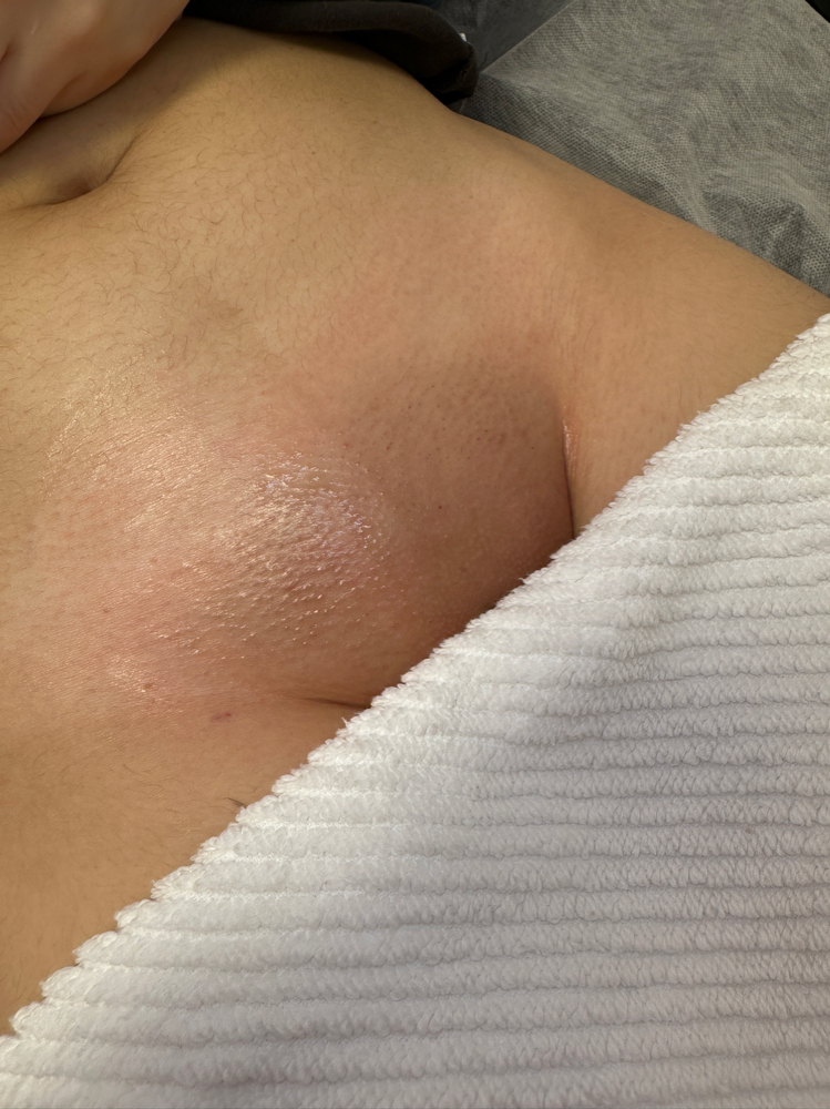 Waxing- Brazilian