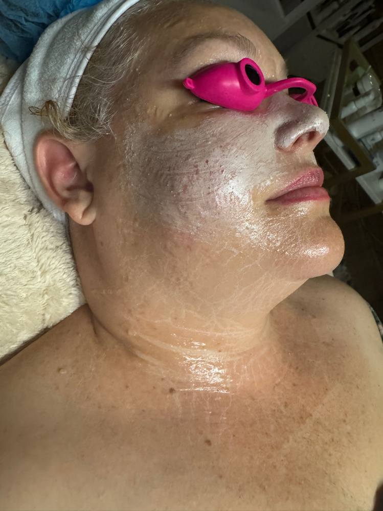 Detox, Acne Facial at Shay’s Peaceful Escape, LLC in San Antonio, TX