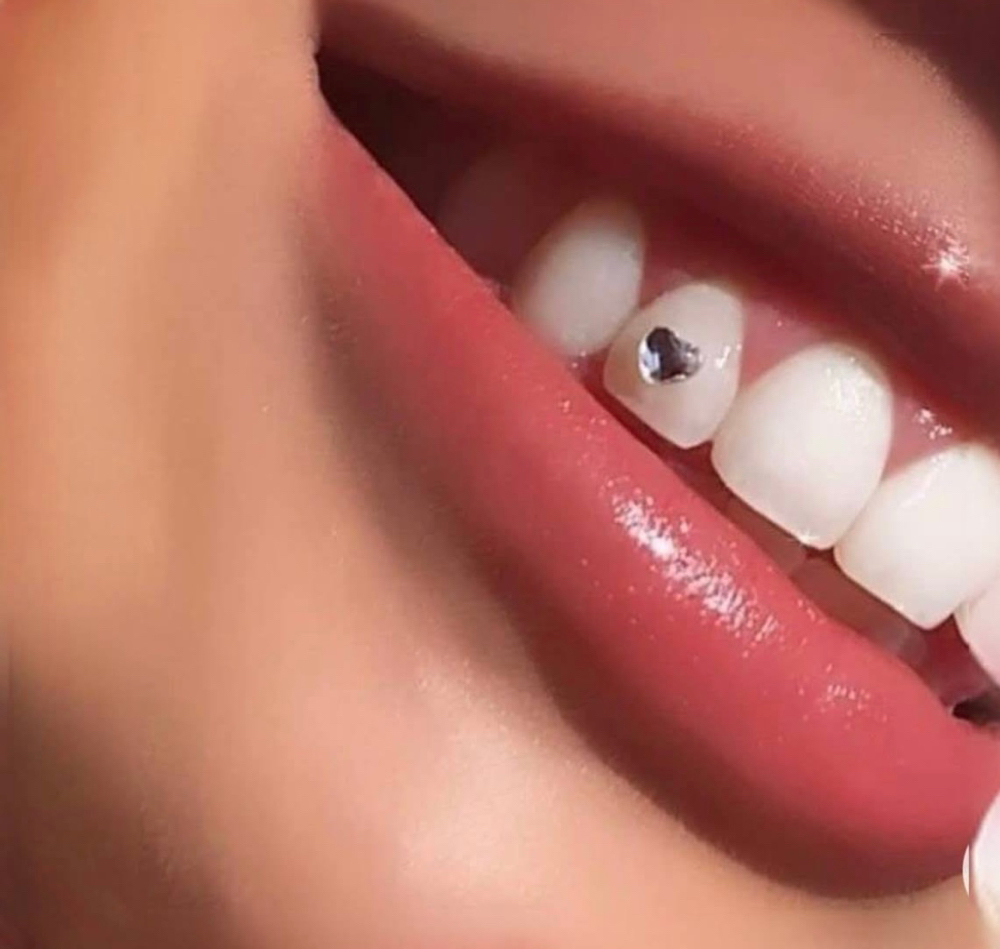 Tooth Gems