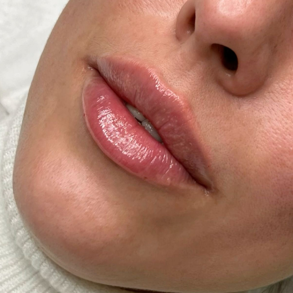 Chin Wax at Aesthetics By Arely in Glendale, AZ