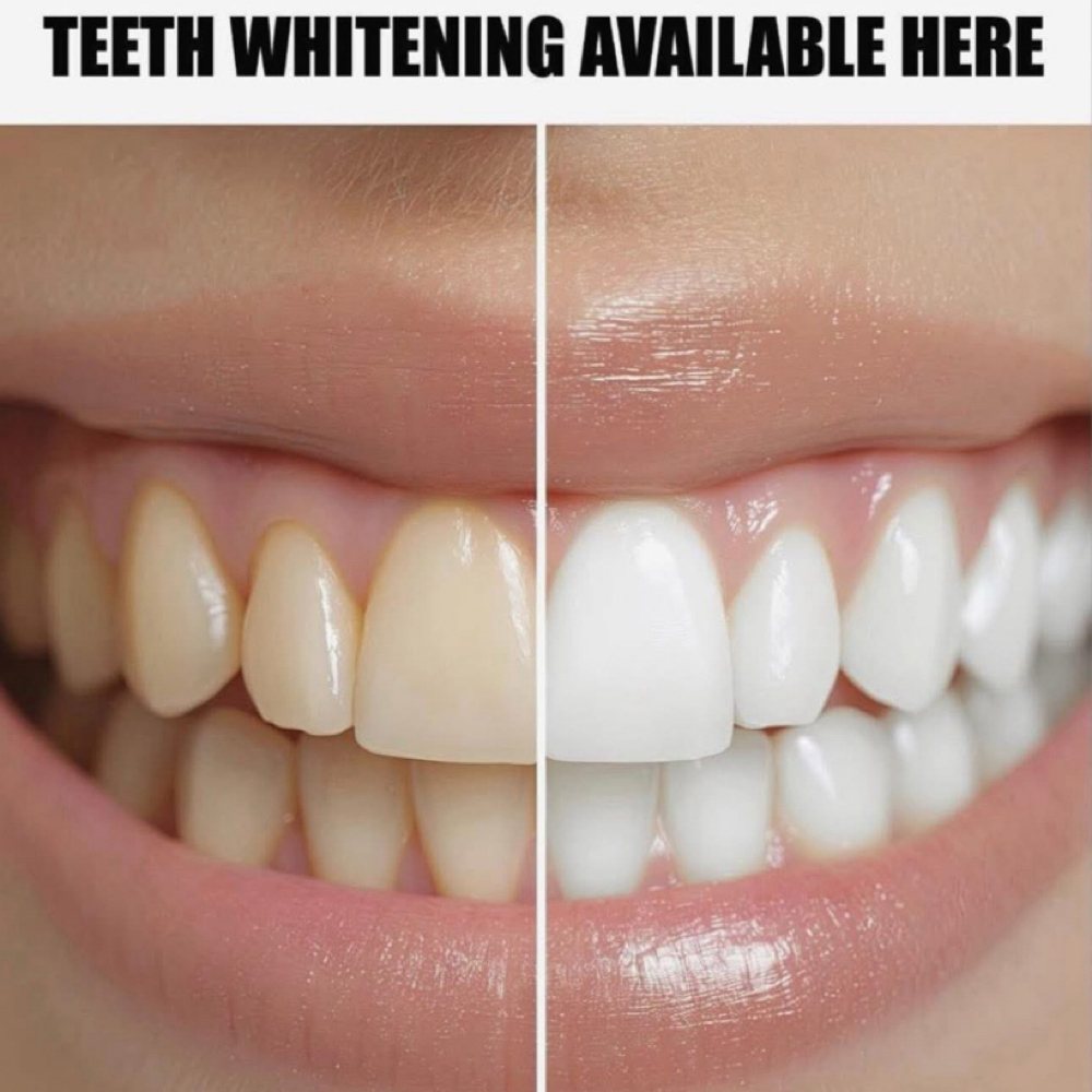 Teeth Whitening at ARock Beauty & Wellness in San Angelo, TX