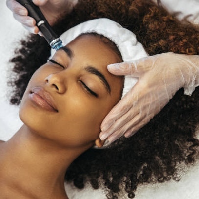 Microdermabrasion