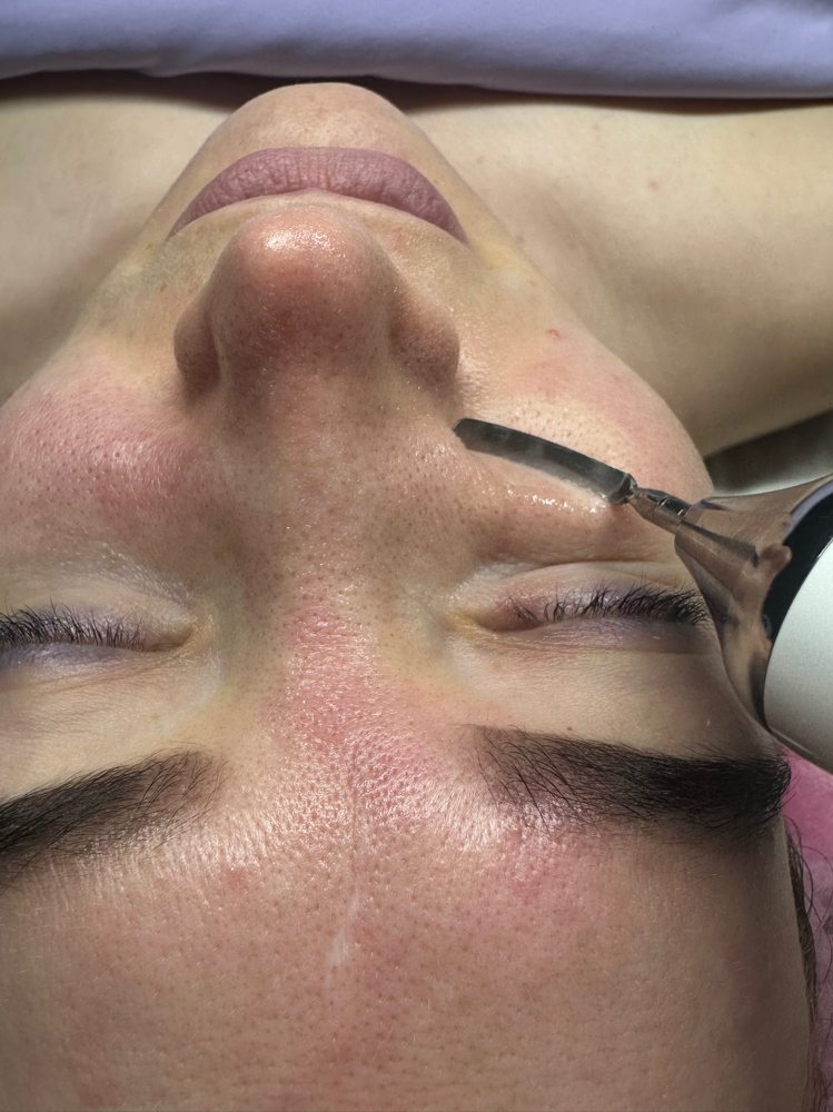Ultrasonic Facial Cleansing