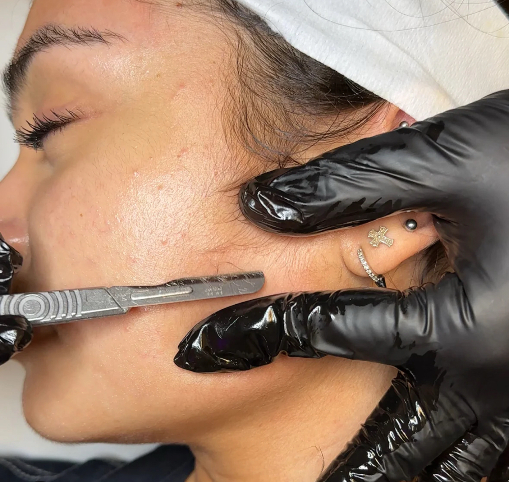 Dermaplane Facial
