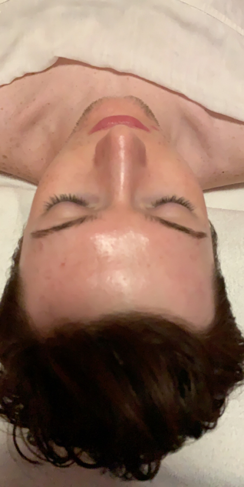 Microdermabrasion Facial