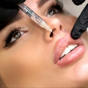 Lip Filler at Blossoms HTX Hair Studio in Spring, TX