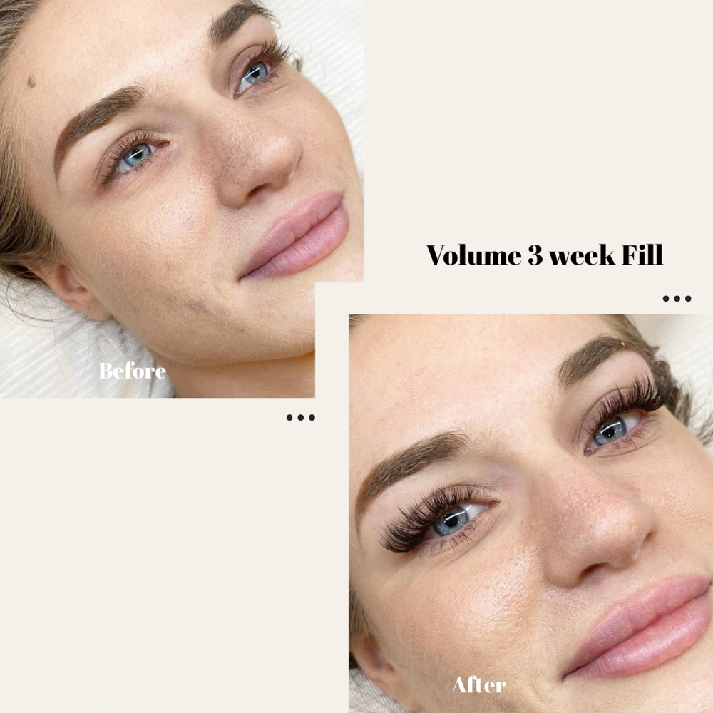 Volume  - 3 week