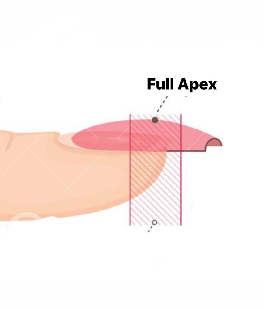 structure gel fill-in (full apex)