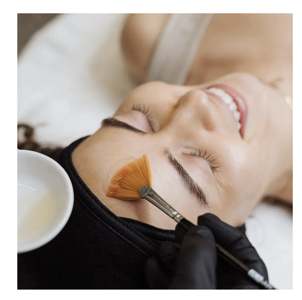 Chemical Peel