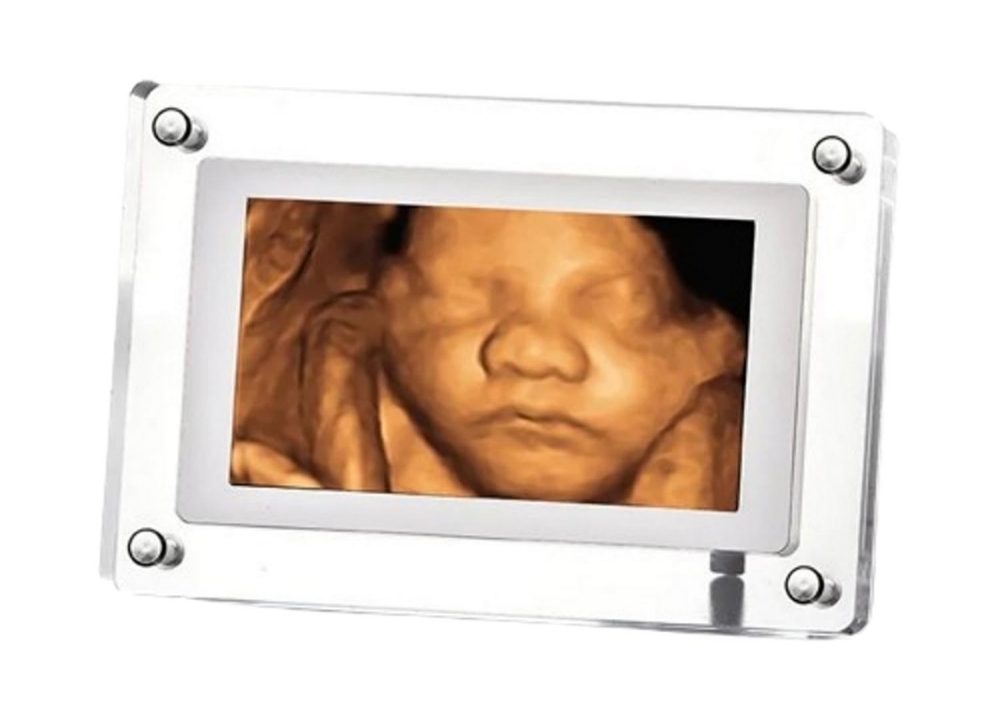Digital 5in Ultrasound Frame at HELLO BABY 3D/4D LLC in Deer Park, TX