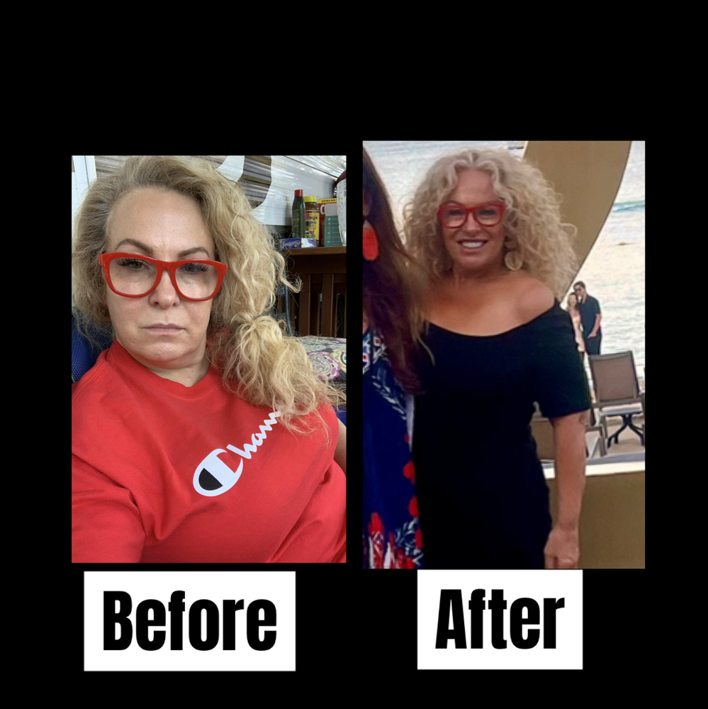 Semiglutide/Botox/Lip Filler Party