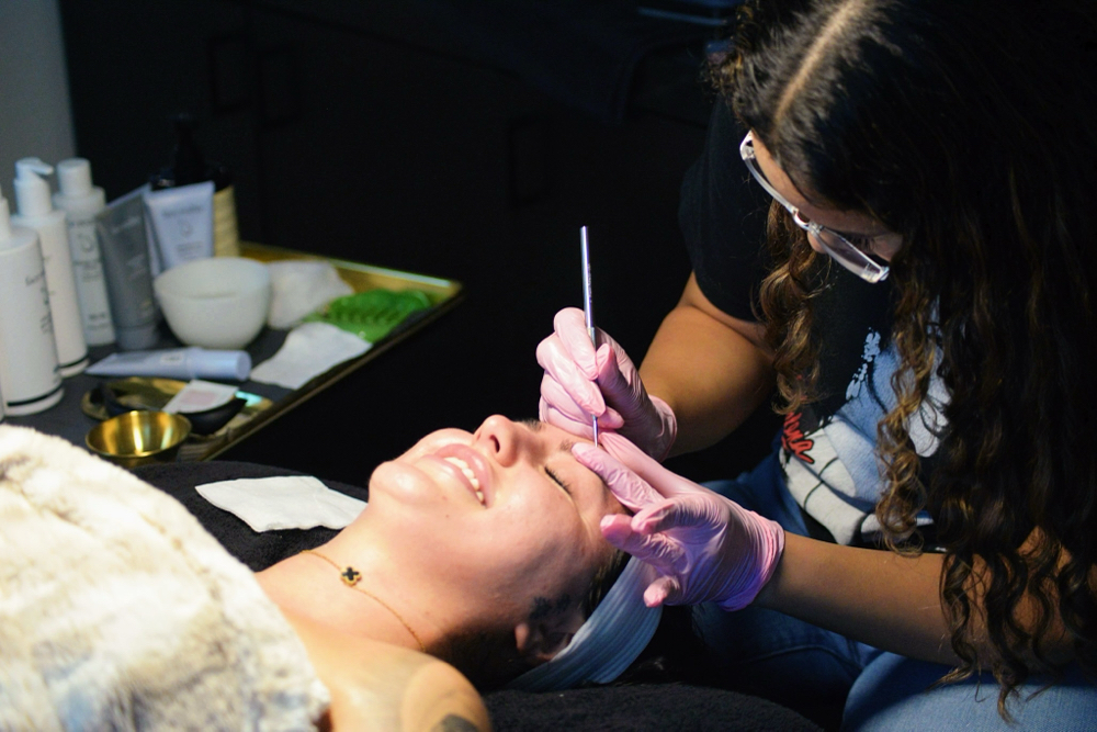 Acne Facial