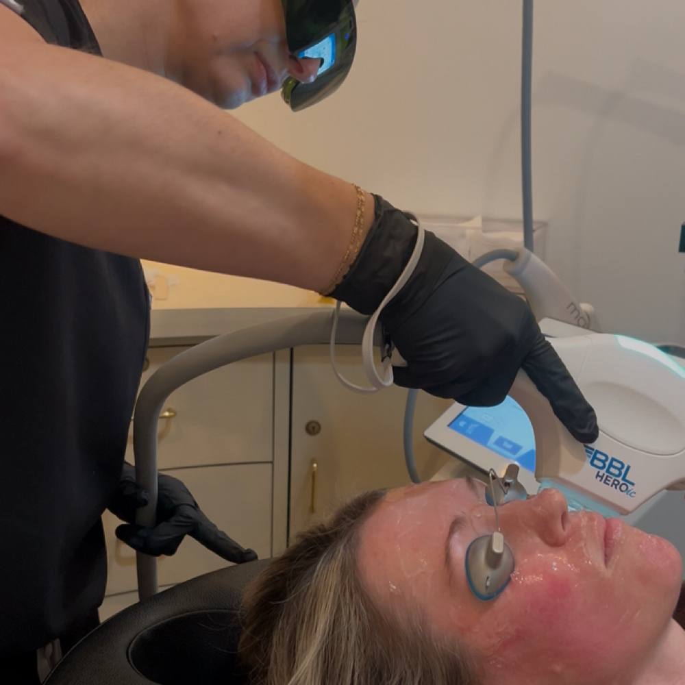 BBL HEROic at Your Body at Timeless Skin & Aesthetics in Bloomfield Hills, MI