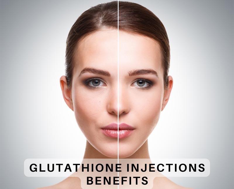 Glutathione IM or IVP  injection