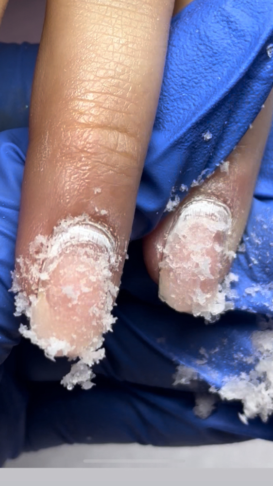 Soak Off / Removal