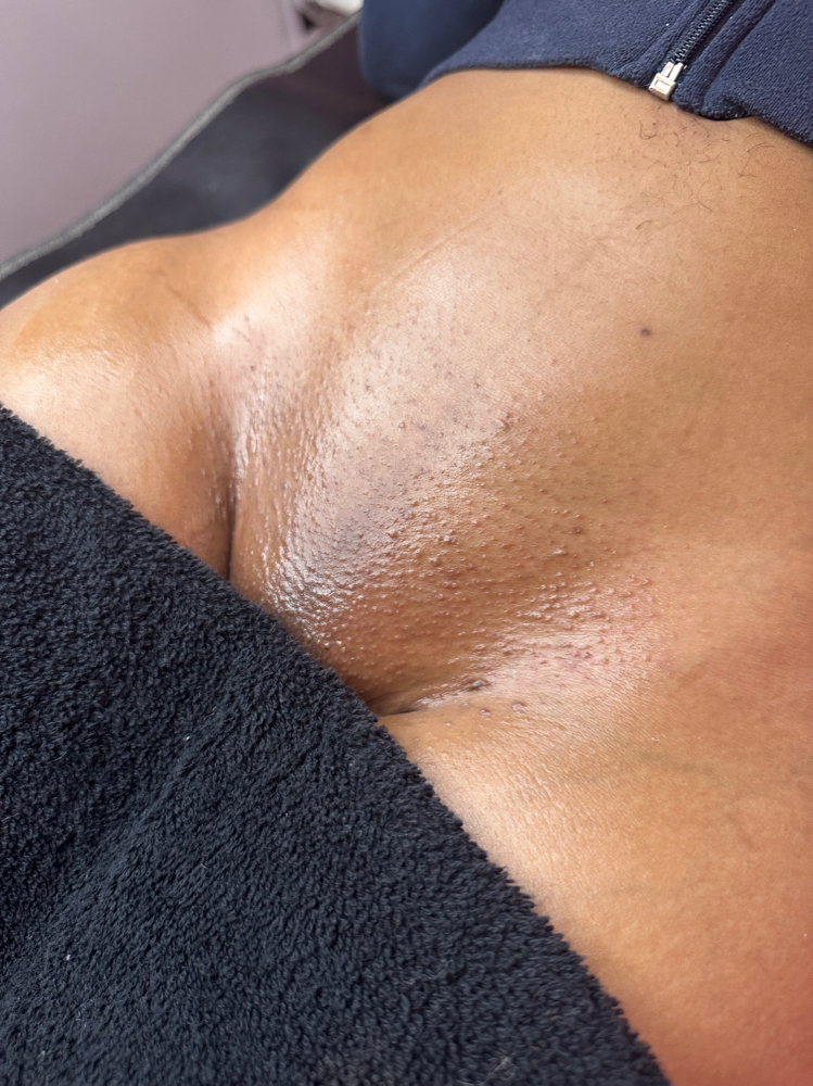Brazilian Wax