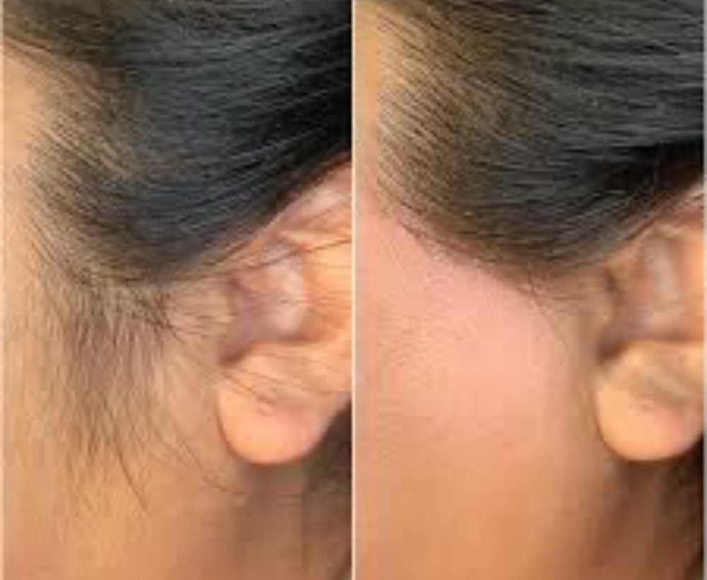Side Burns at The 725 Xperience in Katy, TX