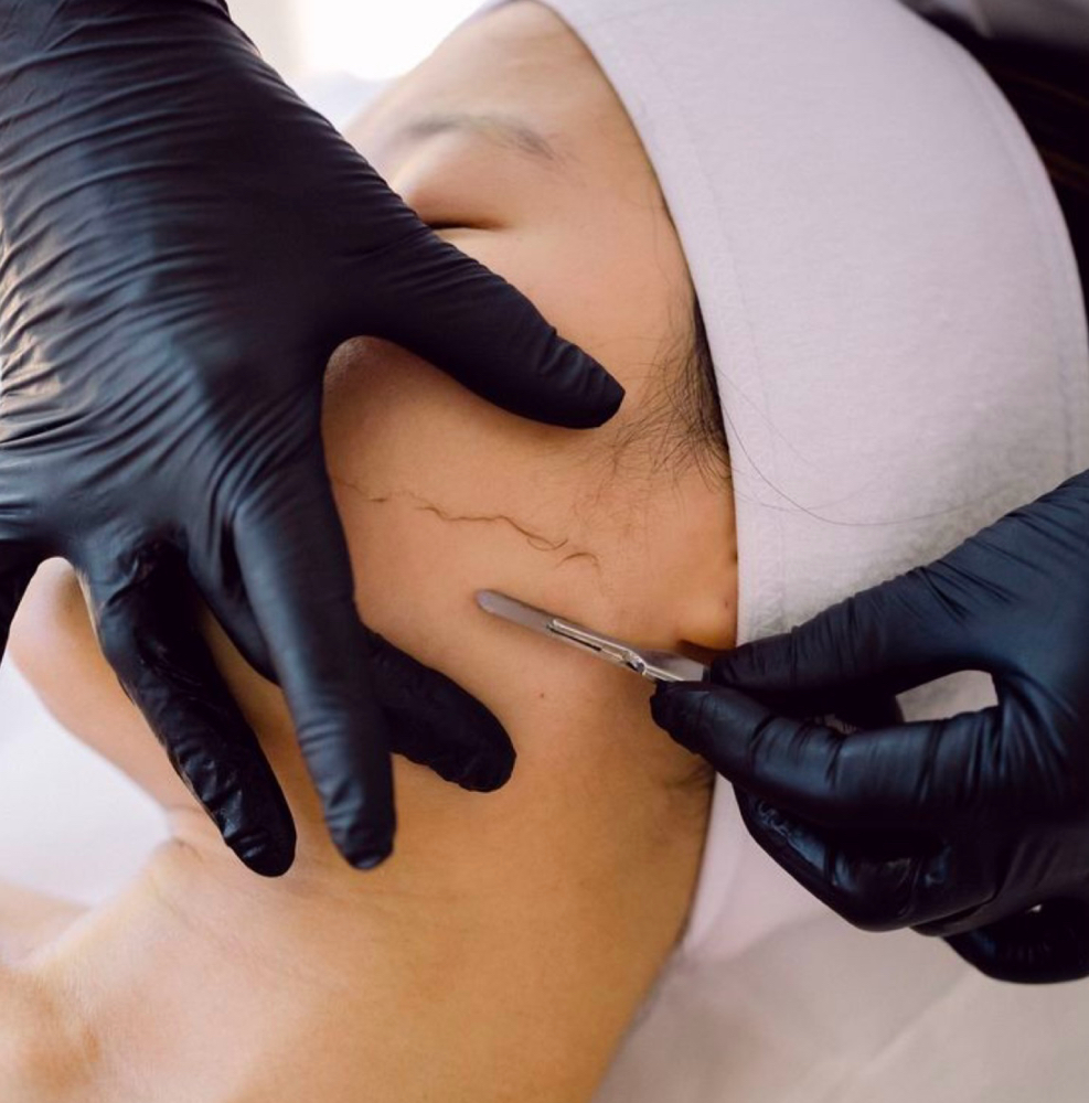 Dermaplane Facial