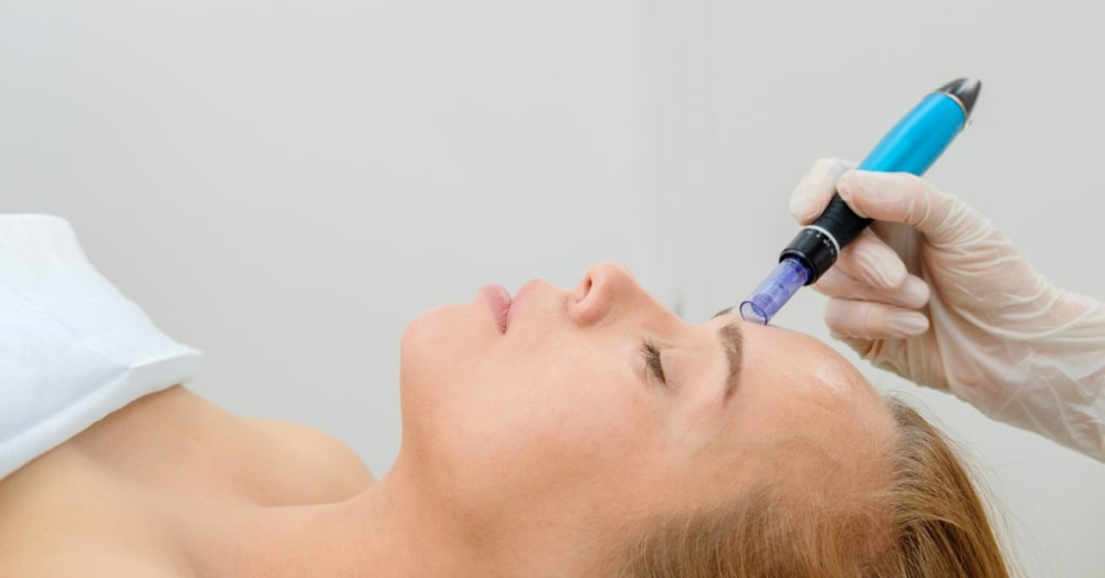 Microneedling Deluxe