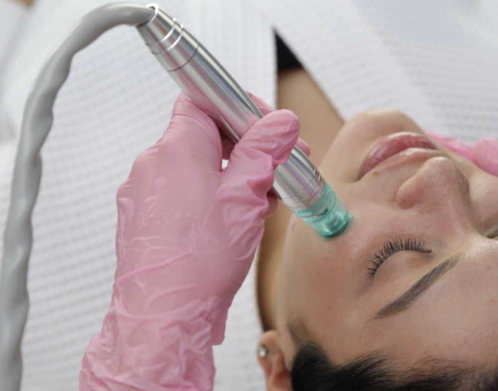 Hydrodermabrasion Facial