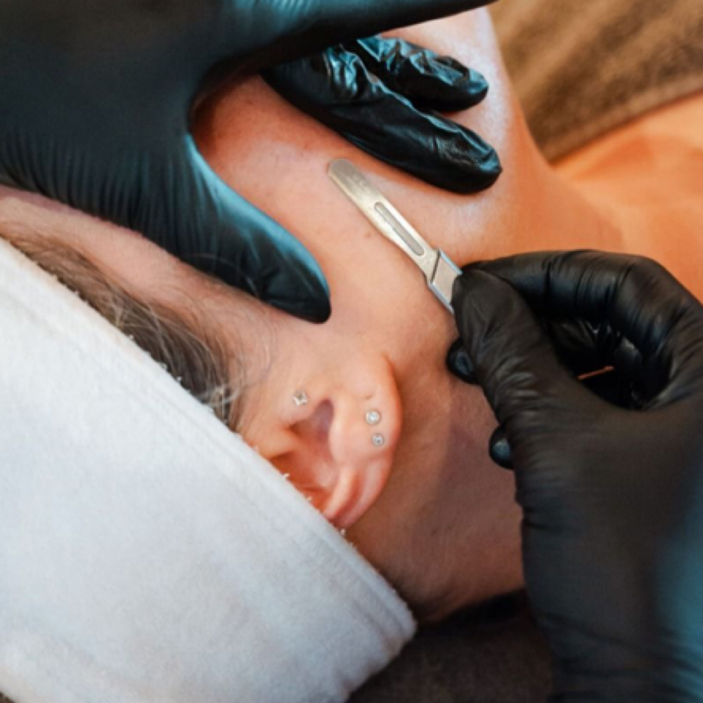 Dermaplaning Add On at LM BEAUTY AESTHETICS in Everett, MA