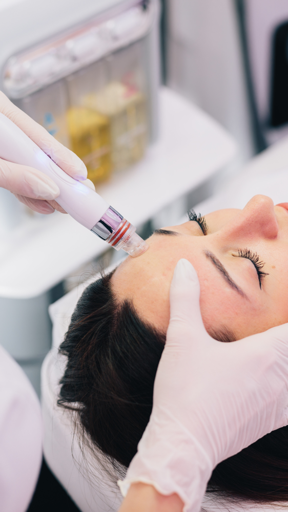 Hydrodermabration Glow at Dreas Body Sculpting in Napa, CA