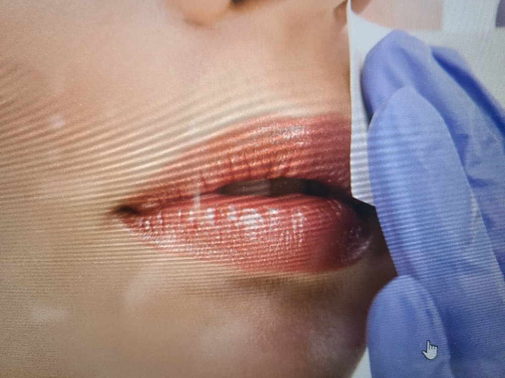 Lip at Kristina's Aesthetics in San Jose, CA