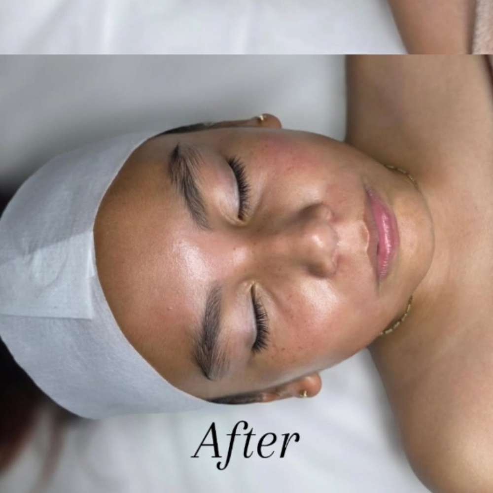 Kids And Teen Facial at SUBLIME BEAUTY STUDIO in MONTEREY, CA