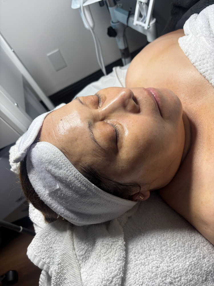 Hydrafacial