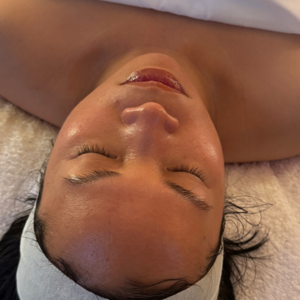 Client Virtual Skin Support Session at Alora Skin in Sacramento, CA