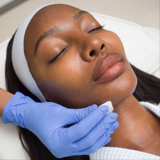 Chemial Peel at Radiant Glow Skin Spa in Beaumont, TX