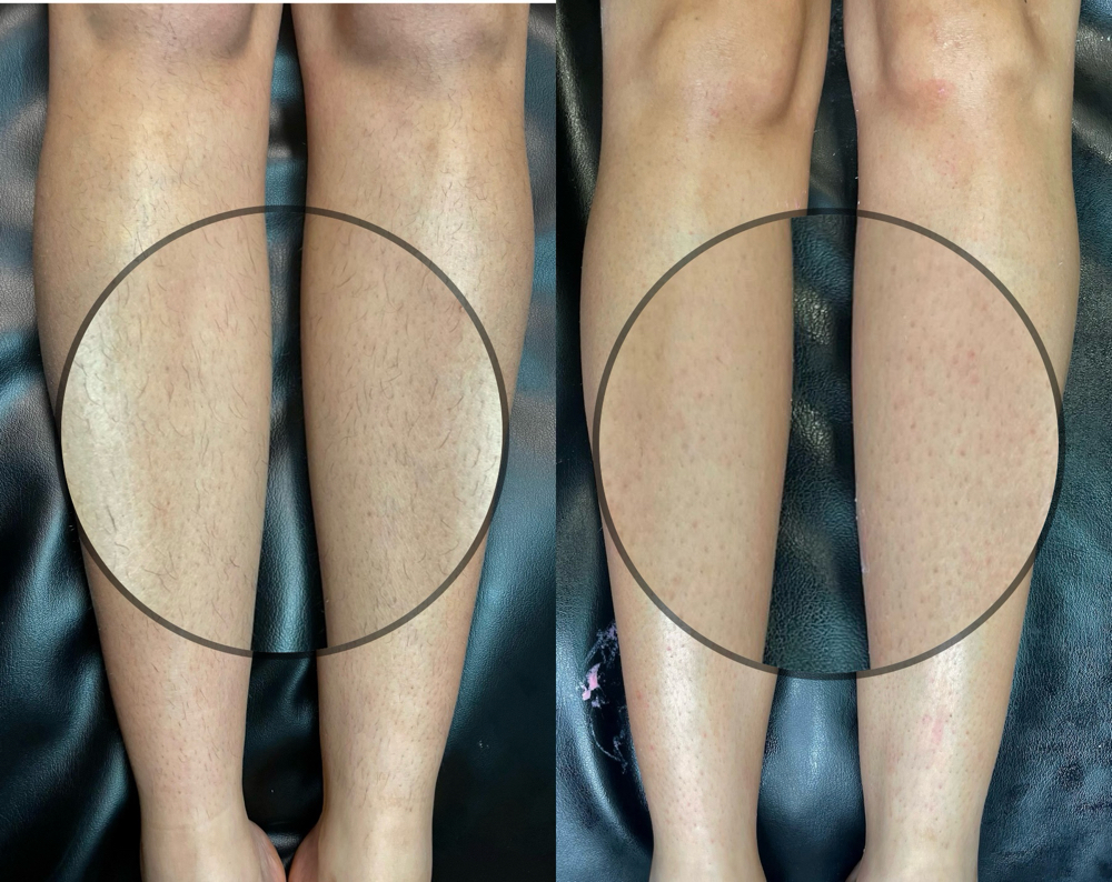 Half Leg Wax (upper Or Lower)